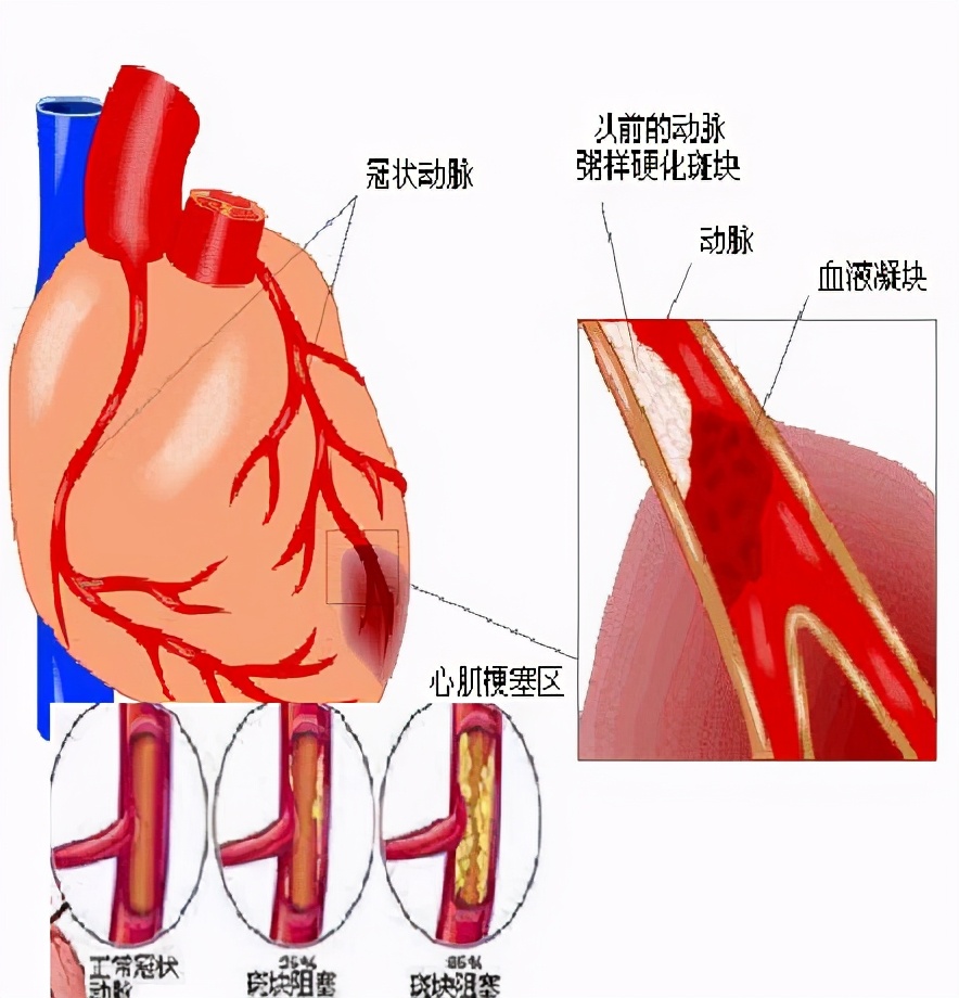 the-30-year-old-heart-gave-birth-to-the-80-year-old-disease-how-should