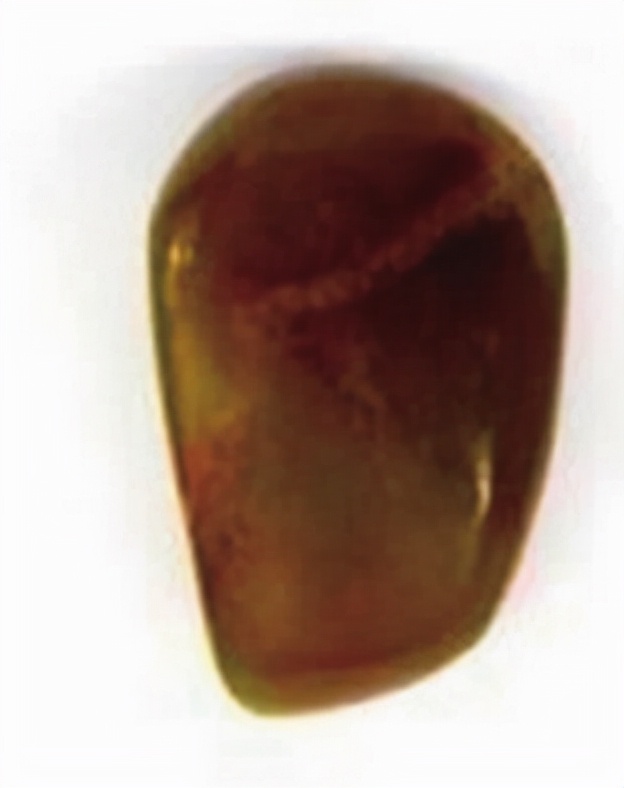 On jade similar to jade iMedia