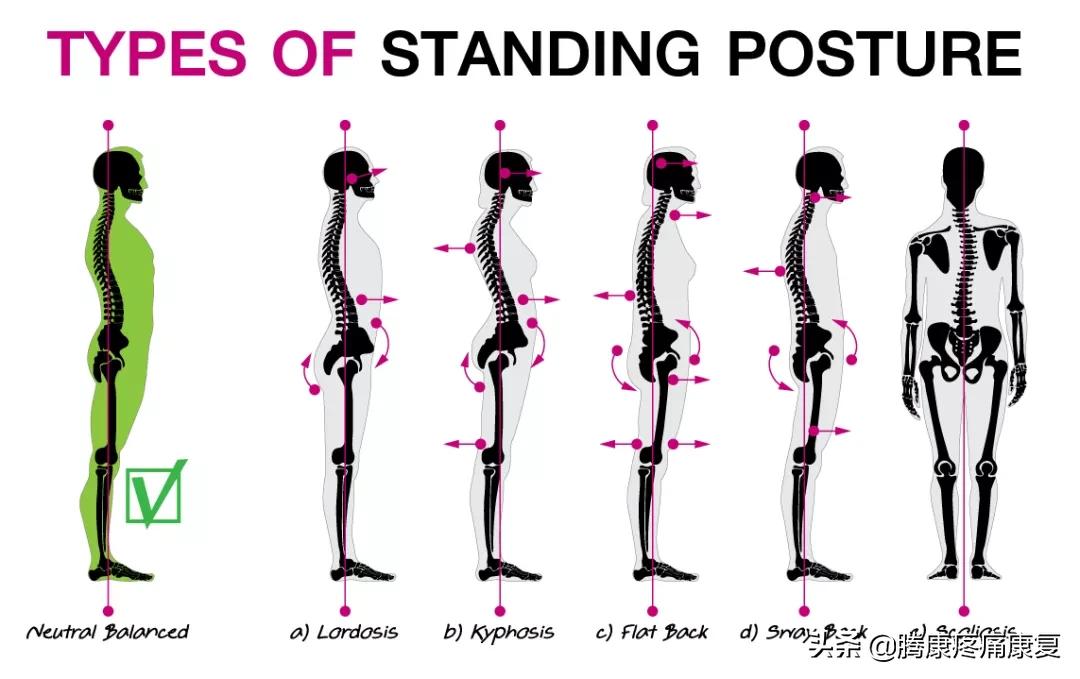 about-these-seven-postures-that-cause-back-pain-maybe-you-do-it-every