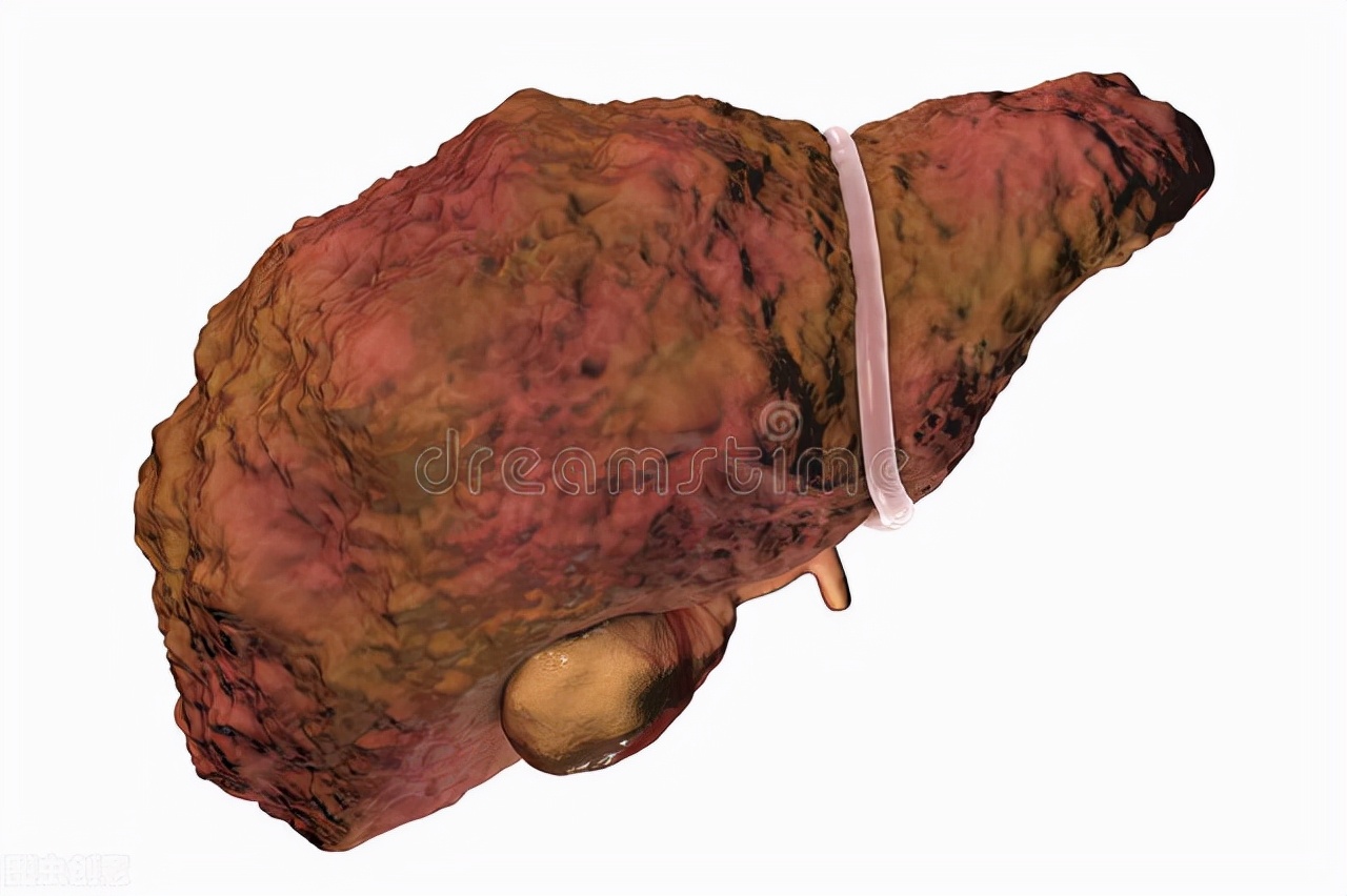 Can eating sashimi with wasabi to kill bacteria and parasites? iMedia