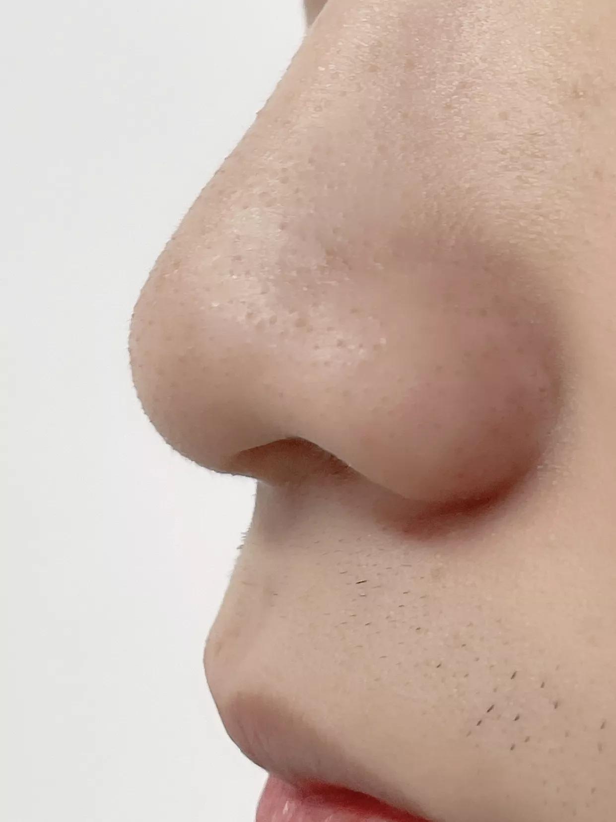 How do I clean my face? iMedia