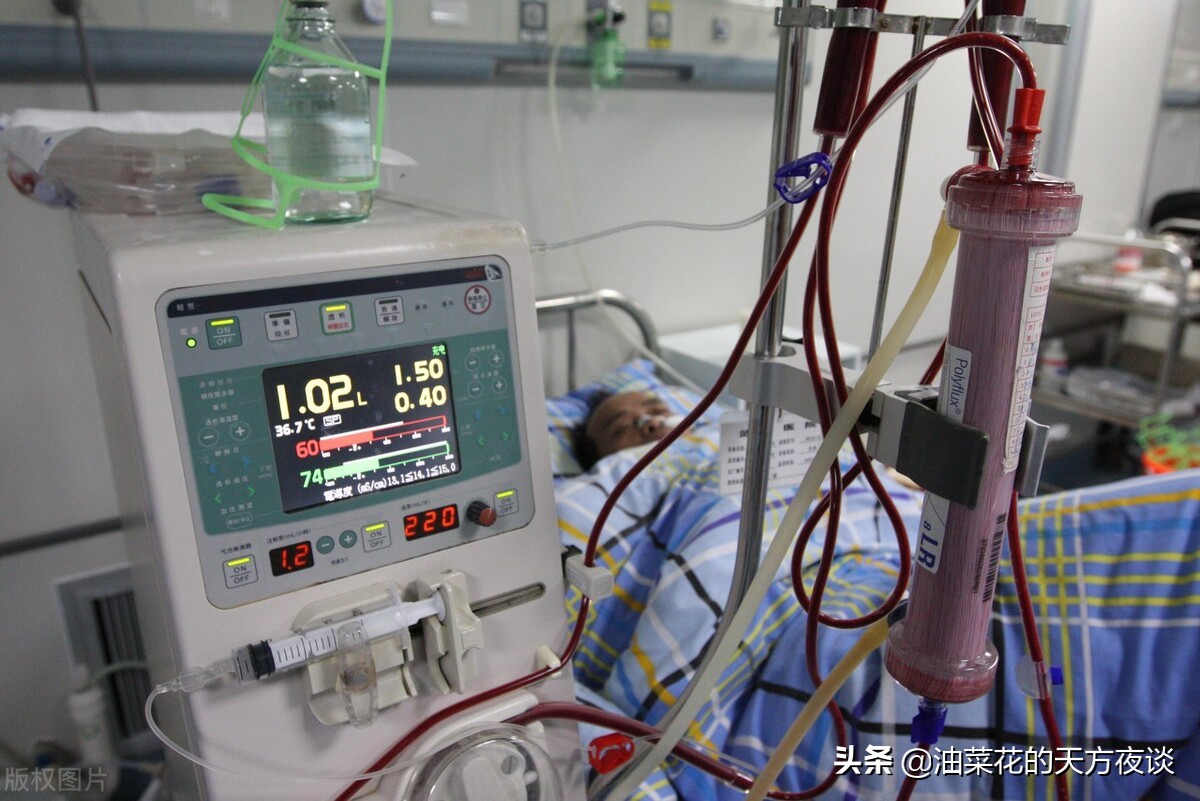 What are the acute complications of hemodialysis? - iMedia