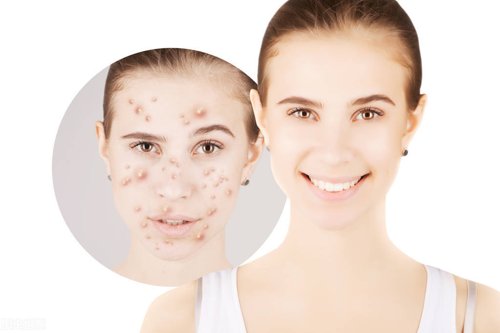 What should I do if I are allergic to all skin care products on the
