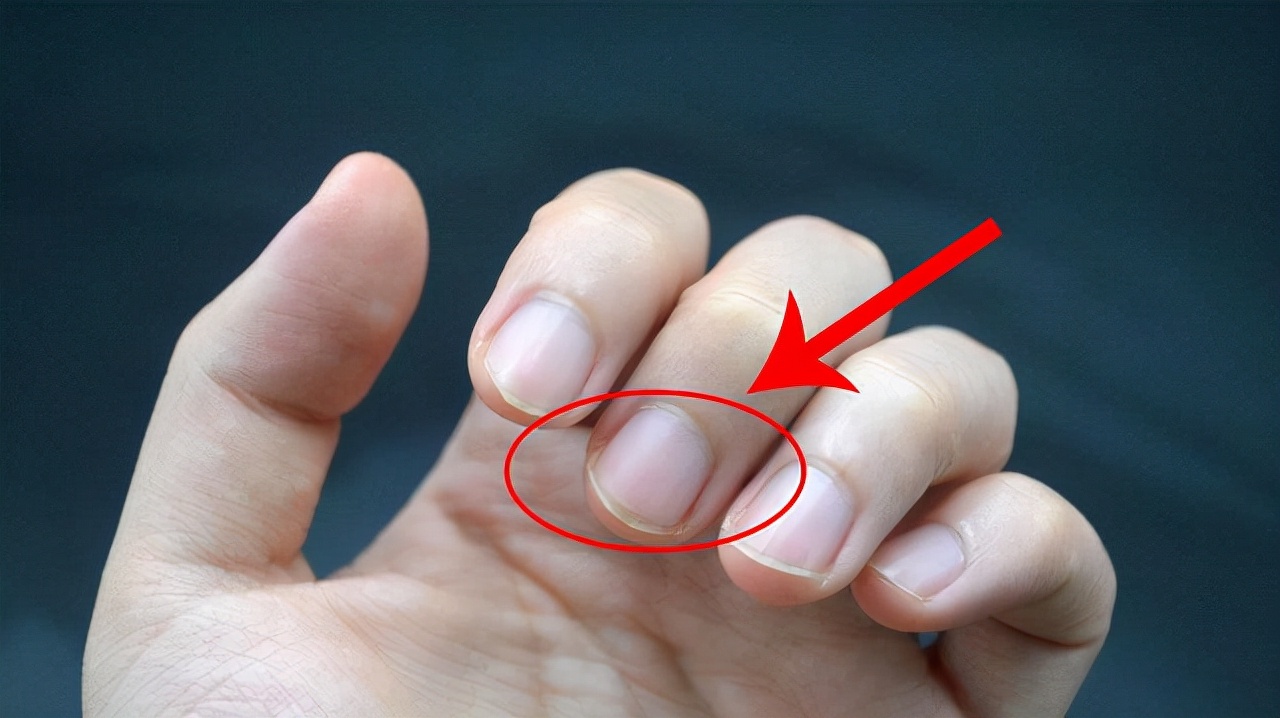 Little Nail University asks!Why do nails have vertical lines and white spots?Why  does the crescent mark disappear? - iMedia
