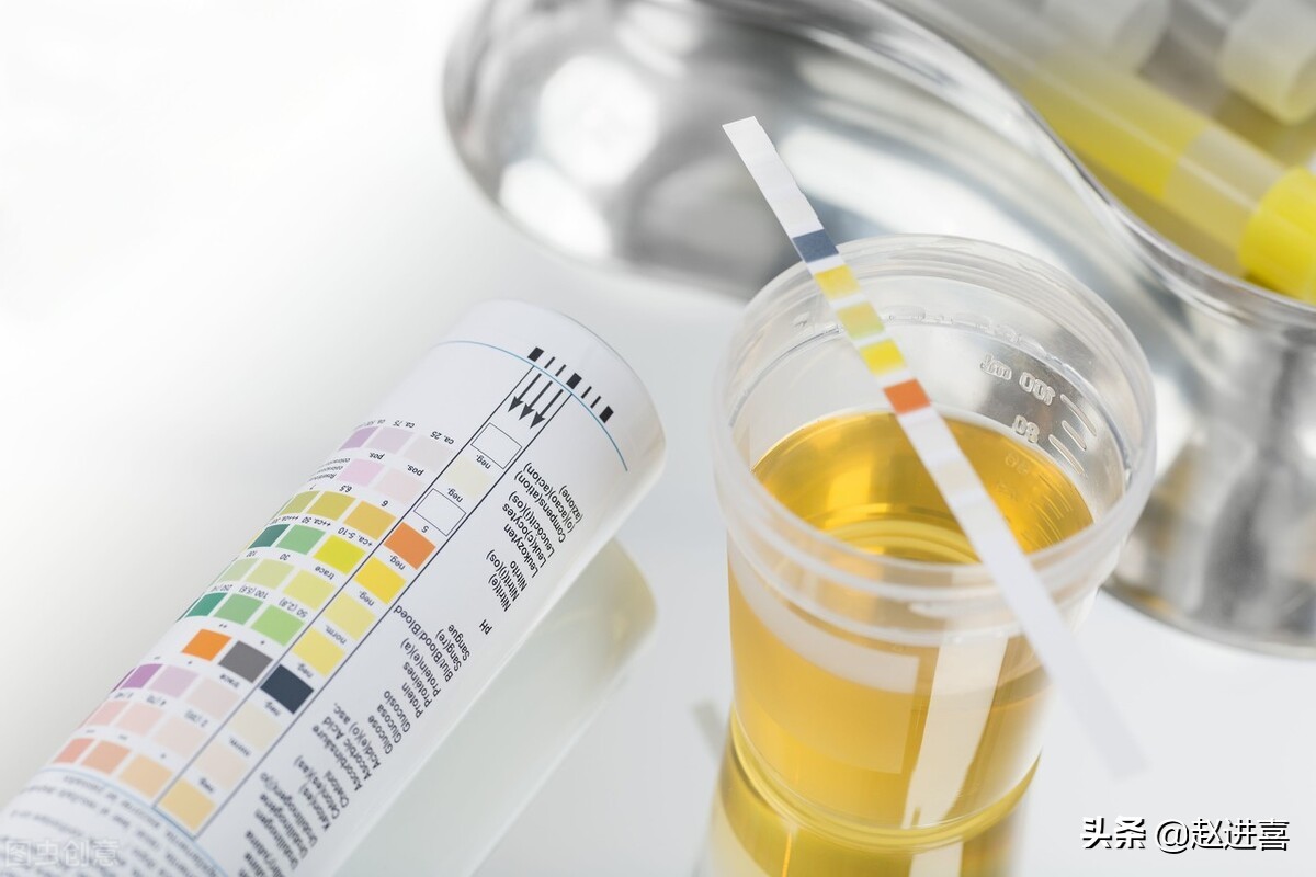 Is urine occult blood 2+ serious?Need treatment? iMedia