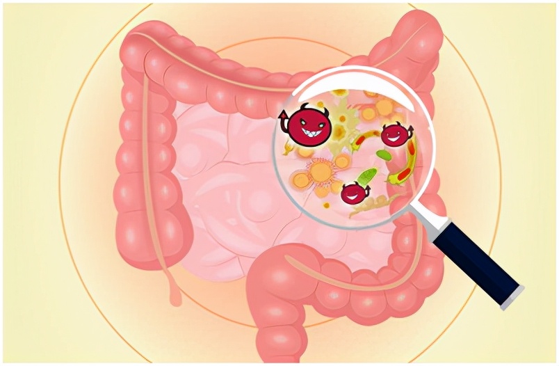 Frequent abdominal pain, diarrhea, mucus, pus and blood in the stool