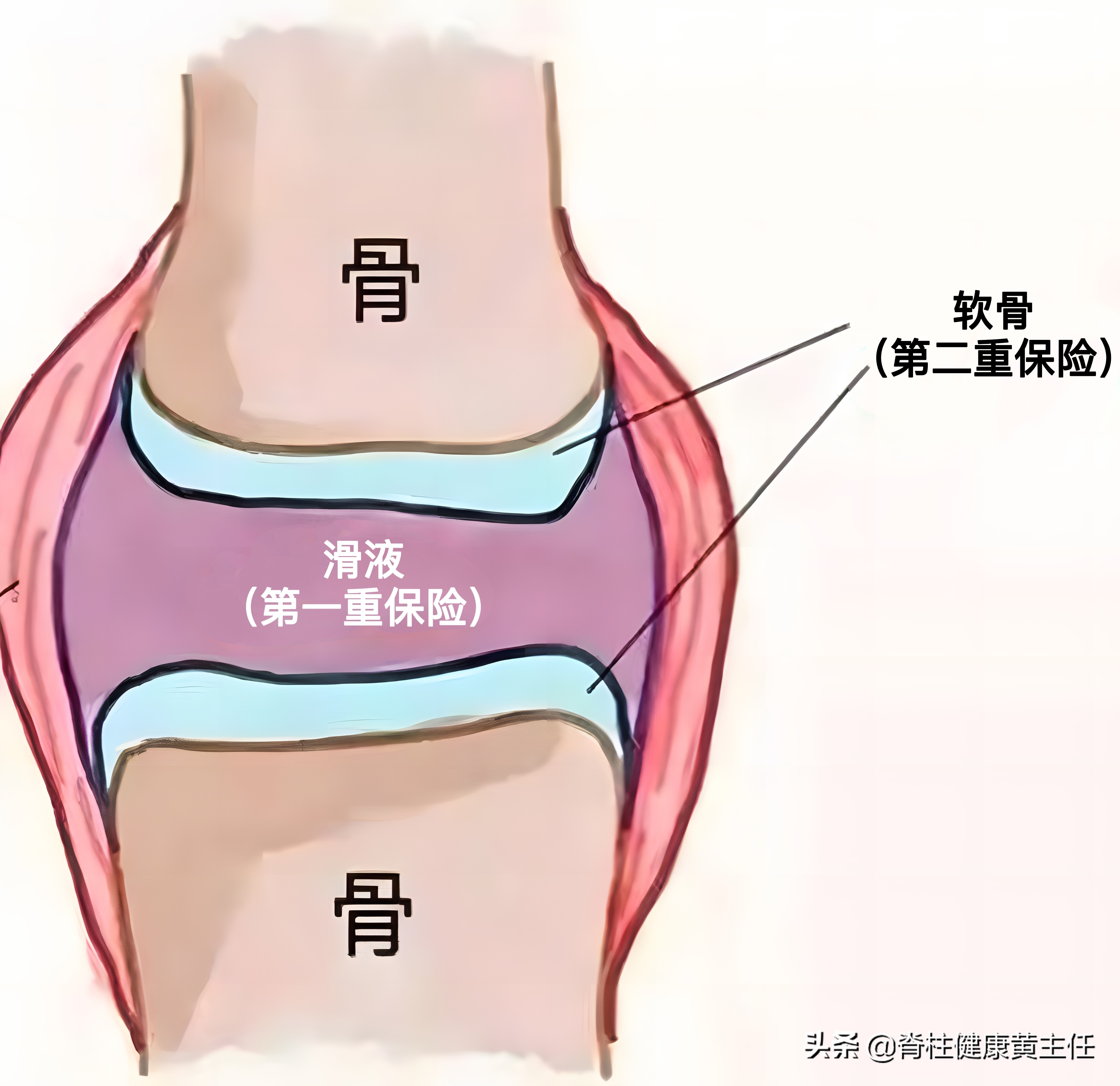 What's wrong with knee effusion?Should the effusion be pumped out