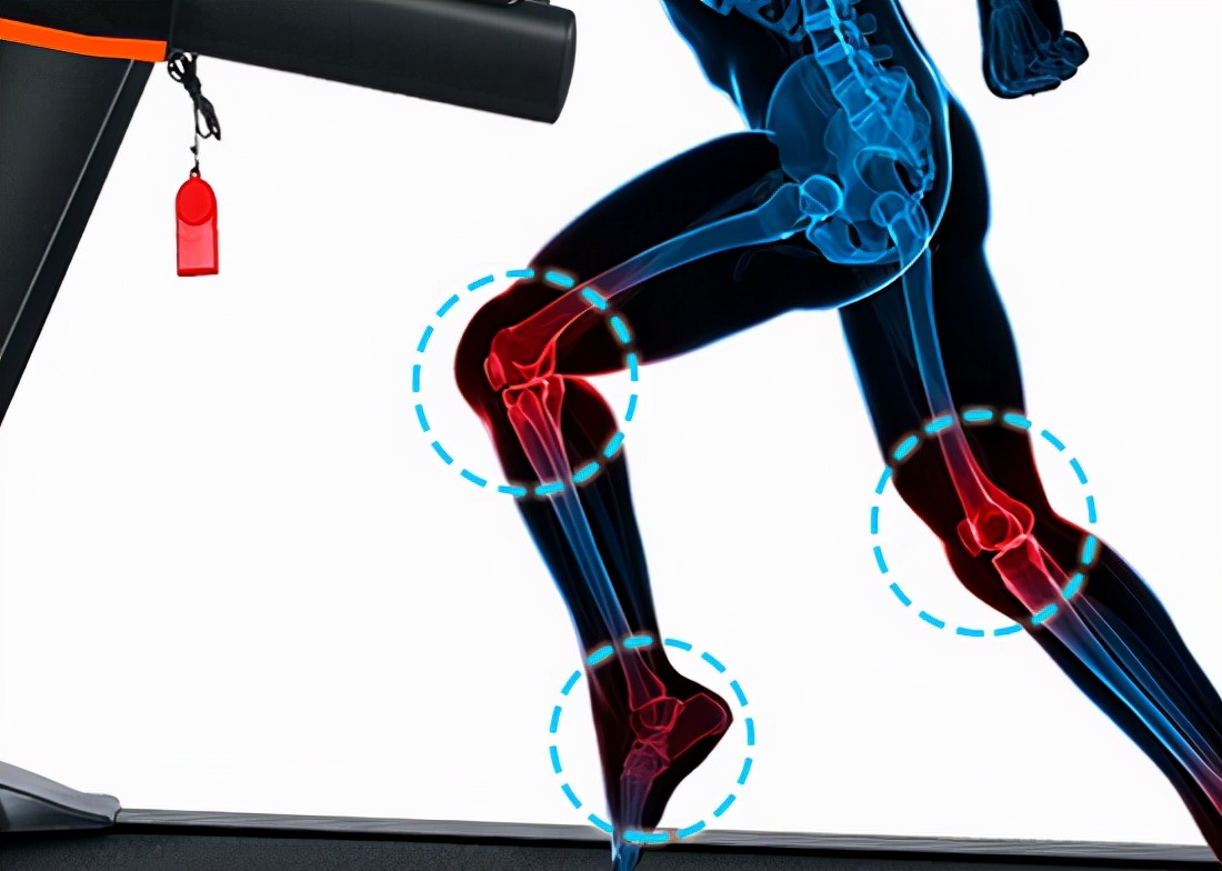 How to Avoid Treadmill Injury to the Knee iMedia